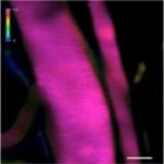 Study: Nanomachines aim to deliver cancer drugs to hard-to-reach areas like the brain — (Details)