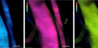 Study: Nanomachines aim to deliver cancer drugs to hard-to-reach areas like the brain — (Details)