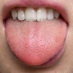 Study: Identification of functional olfactory receptors in human taste cells opens doors to new approaches to modify food flavor — (Details)