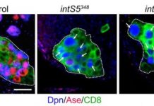 Research: Proteins stand up to nerve cell regression —