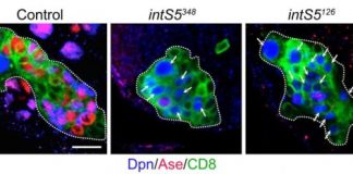 Research: Proteins stand up to nerve cell regression —