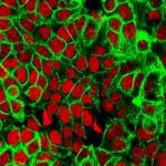 Study: Exposing cancer's metabolic addictions (Details)