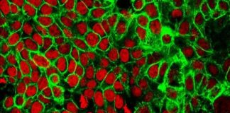 Study: Exposing cancer's metabolic addictions (Details)