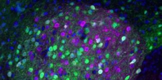 Study: Why is it so easy to overeat calorie-rich tasty foods? — (Details)