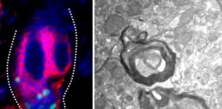 Research: Stem cells that yield pigment-producing cells also regenerate the myelin sheath that coats neurons —