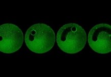 Research: An army of micro-robots can wipe out dental plaque —