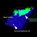 Study: Key to targeting dormant cancer cells — (Details)