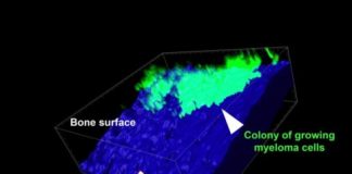 Study: Key to targeting dormant cancer cells — (Details)