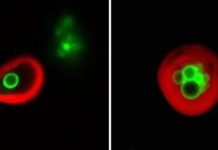 Research: Plant cells eat their own … membranes and oil droplets —