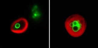 Research: Plant cells eat their own … membranes and oil droplets —
