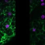 Study: Glial cells may play key epilepsy role — (Details)