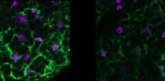 Study: Glial cells may play key epilepsy role — (Details)