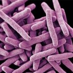 Candida Auris: Mysterious and dangerous fungal infection Candida Auris: Mysterious and dangerous fungal infection