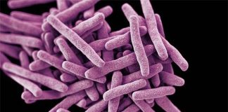 Candida Auris: Mysterious and dangerous fungal infection Candida Auris: Mysterious and dangerous fungal infection