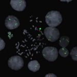 Study: Research may inform drug regimens for improved outcomes — (Details)