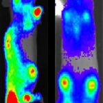 Study: Researchers ready B cells for novel cell therapy — (Details)