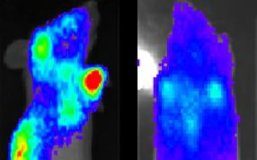 Study: Researchers ready B cells for novel cell therapy — (Details)