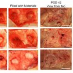 Study: If successful in human trials, this product would lessen the need for implants or tissue grafts — (Details)
