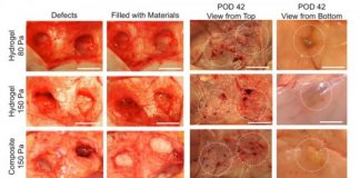 Study: If successful in human trials, this product would lessen the need for implants or tissue grafts — (Details)