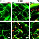 Study: New chemical probe for visualizing brain immune cells — (Details)