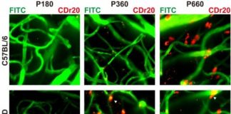 Study: New chemical probe for visualizing brain immune cells — (Details)