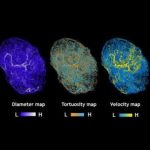 Study: Image-based computer model reveals finer details of tumor blood flow — (Details)