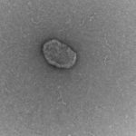 Study: Stem cells make more ‘cargo’ packets to carry cellular aging therapies — (Details)