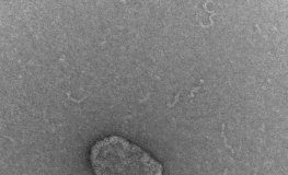 Study: Stem cells make more ‘cargo’ packets to carry cellular aging therapies — (Details)