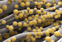 Research: On the way to fighting staph infections with the body’s immune system —