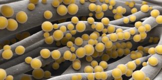 Research: On the way to fighting staph infections with the body’s immune system —