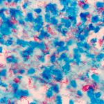 Study: Discovery may provide a new target for TB drugs, vaccines, research suggests — (Details)