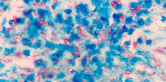 Study: Discovery may provide a new target for TB drugs, vaccines, research suggests — (Details)