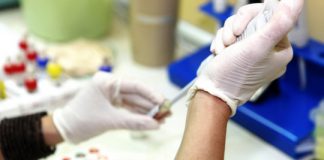 Study: Experts prioritize research to achieve sustained ART-free HIV remission — (Details)