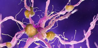 Research: Alzheimer’s disease protein links plaques to cell death in mice —