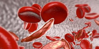 Research: Targeting a blood stem cell subset shows lasting, therapeutically relevant gene editing —