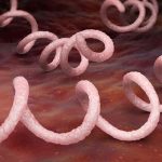 Report: syphilis notifications up by 70% since 2010 Report: syphilis notifications up by 70% since 2010