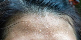 Research: New easy-to-make sensors can provide real-time measurements of sweat rate and electrolytes and metabolites in perspiration —