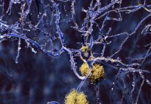 Research: Biochemists discover new insights into what may go awry in brains of Alzheimer’s patients —