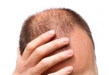 Research: Electric tech could help reverse baldness —