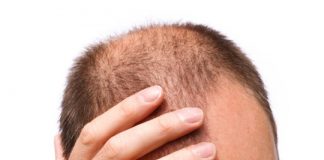Research: Electric tech could help reverse baldness —