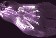 Study: Ancient reptilian limb muscles found in human fetuses Study: Ancient reptilian limb muscles found in human fetuses