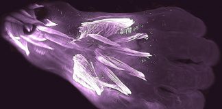 Study: Ancient reptilian limb muscles found in human fetuses Study: Ancient reptilian limb muscles found in human fetuses