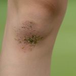 Study: Humans have ability to regrow cartilage Study: Humans have ability to regrow cartilage