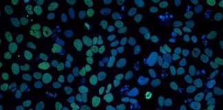 New study targets stem cells that drive aggressive blood cancer New study targets stem cells that drive aggressive blood cancer