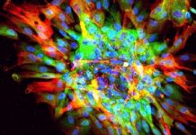 Scientists create accurate model of organ scarring using stem cells in a lab Scientists create accurate model of organ scarring using stem cells in a lab