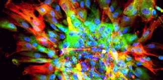 Scientists create accurate model of organ scarring using stem cells in a lab Scientists create accurate model of organ scarring using stem cells in a lab