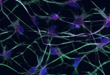 Study: Stem cell technology offers new insight into MND Study: Stem cell technology offers new insight into MND