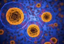 Study: Worm reveals way to destroy toxic cells in Huntington’s disease Study: Worm reveals way to destroy toxic cells in Huntington's disease