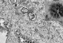 Modeling research estimates spread of 2019 novel coronavirus Modeling research estimates spread of 2019 novel coronavirus
