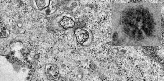 Modeling research estimates spread of 2019 novel coronavirus Modeling research estimates spread of 2019 novel coronavirus